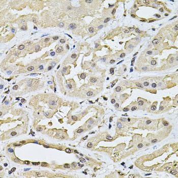 Polyclonal Rabbit anti-Human SP110 Antibody (IHC)