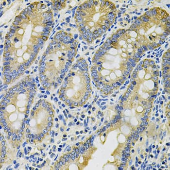 KRT20 / CK20 / Cytokeratin 20 Antibody