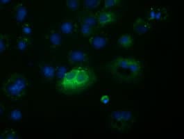 FSHB / FSH Beta Antibody (clone OTI3A9)