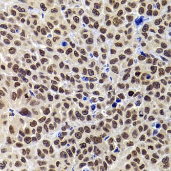 WDR11 / PHIP Antibody