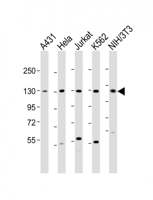 DDX42 Antibody (aa104-138)