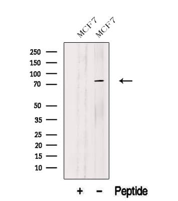 ASUN / C12orf11 Antibody