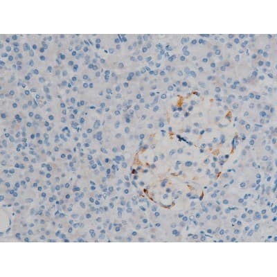 MAPK3 / ERK1 Antibody (phospho-Tyr204,pThr202)
