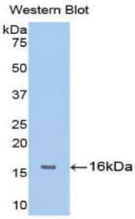FGFR1 / FGF Receptor 1 Antibody (aa236-362, FITC)