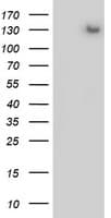PR / Progesterone Receptor Antibody (aa1-298, clone OTI2F8)