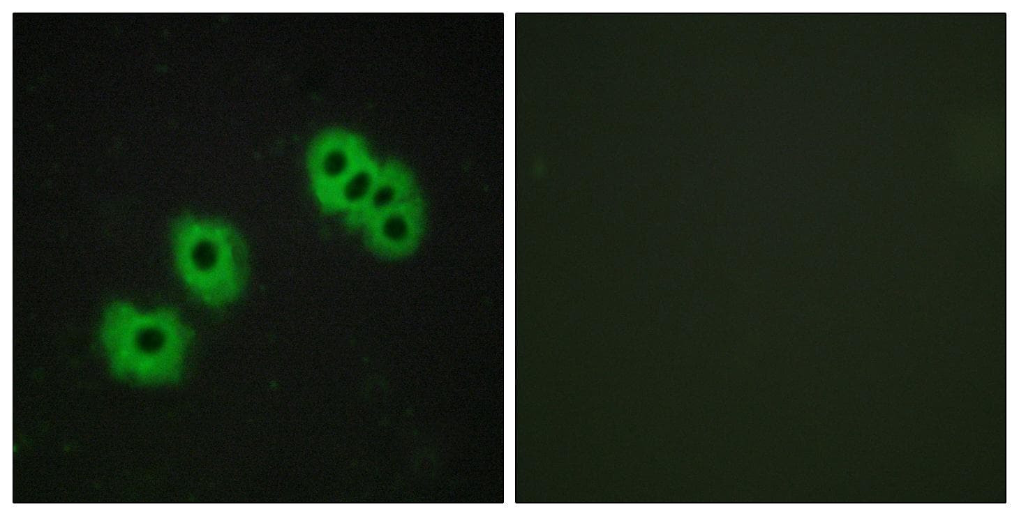 P2RY14 / GPR105 Antibody