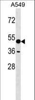 AMY1A / Salivary Amylase Antibody (aa359-388)