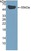 Human IL12A / p35 Protein (Recombinant His, N-Terminal)