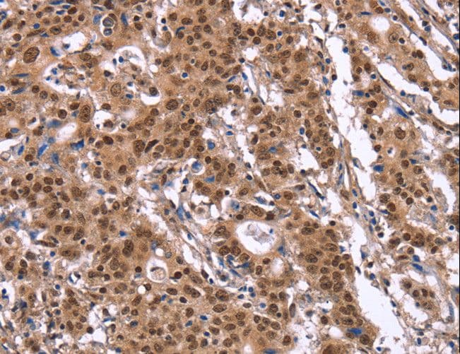 ID4 Antibody