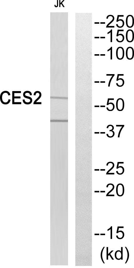 CES2 / Esterase Antibody