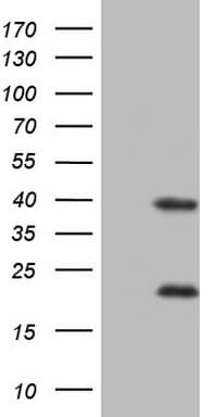 Monoclonal Mouse anti-Human NR1I3 / CAR Antibody (clone OTI8E3, aa1-236, WB)