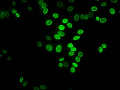 Polyclonal Rabbit anti-Human HIST1H3A Antibody (IHC, IF, WB)
