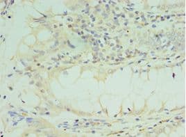 Polyclonal Rabbit anti-Human TICAM2 / TRAM Antibody (aa1-235, IHC)