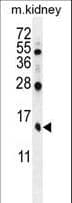 Polyclonal Rabbit anti-Human TBCA Antibody (aa30-58, IHC, WB)