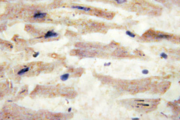 LAMA4 / Laminin Alpha 4 Antibody (Ala511)