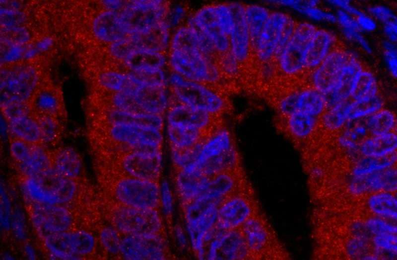 USP5 Antibody (aa375-425)