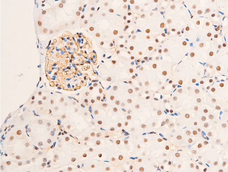 NR3C1/Glucocorticoid Receptor Antibody (phospho-Ser203)