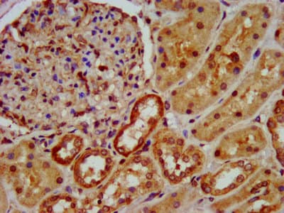 OCC1 Antibody