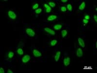 NAB1 Antibody (clone 2607C2a)