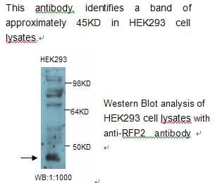 TRIM13 Antibody