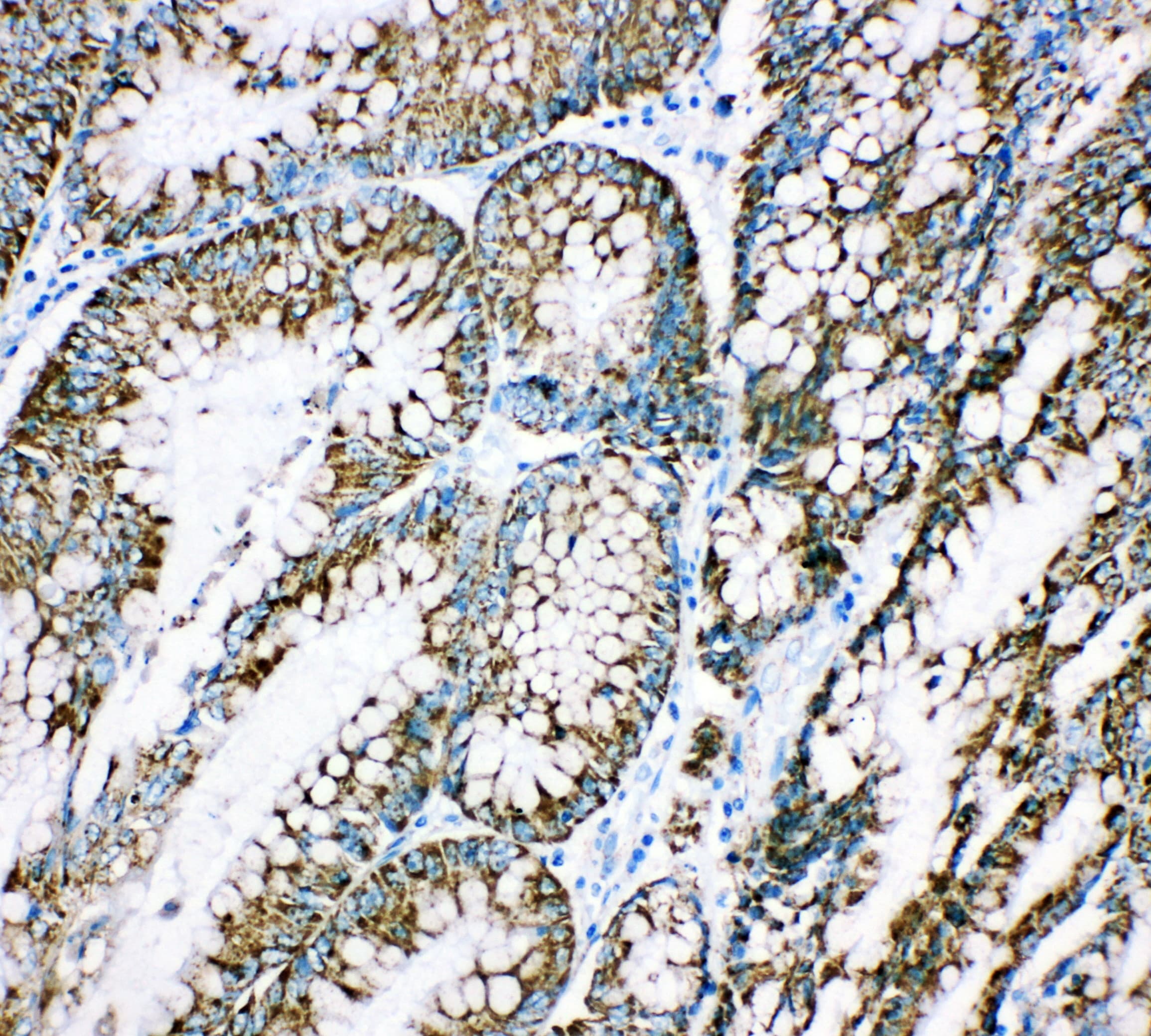 HSPE1 / HSP10 / Chaperonin 10 Antibody (aa81-102)