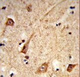 GALNT2 Antibody (aa26-53)
