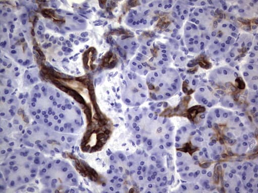 KRT19 / CK19 / Cytokeratin 19 Antibody (aa240-390, clone OTI1A8)