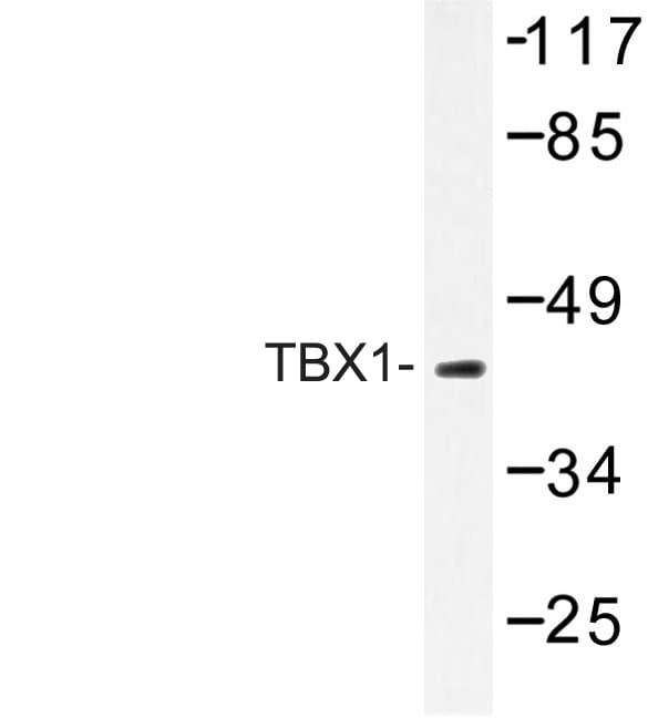 TBX1 Antibody (Lys347)