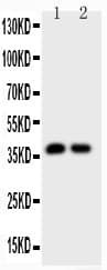 CALB1 / Calbindin Antibody (aa2-175)