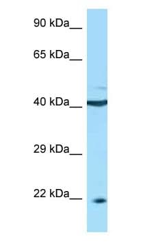 Polyclonal Rabbit anti-Human BAFF Receptor / CD268 Antibody (C-Terminus, WB)