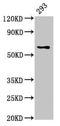 Polyclonal Rabbit anti-Human LPCAT2 Antibody (IHC, WB)