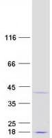 Human CCDC106 Protein (Recombinant Myc-DDK (Flag))