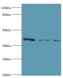 RRM2B / P53R2 Antibody (aa1-351)