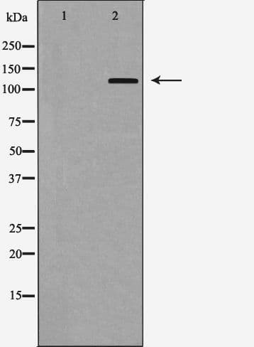 ITGAE / CD103 Antibody