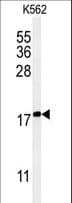 Polyclonal Rabbit anti-Human KRTAP1-1 Antibody (aa88-117, IHC, WB)
