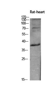 INHBE / Activin Antibody