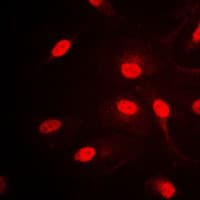 TFAP2A + TFAP2B Antibody (C-Terminus)
