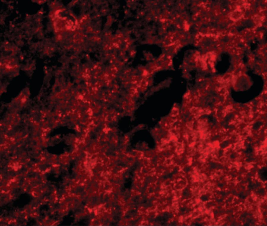 IHC-plus™ Polyclonal Rabbit anti-Human SLITRK1 Antibody (IHC, IF, WB)