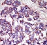 Polyclonal Rabbit anti-Human LATS1 Antibody (aa1-30, IHC, WB)