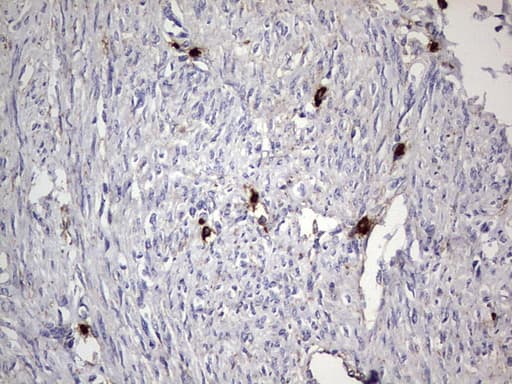 Monoclonal Mouse anti-Human CD63 Antibody (clone OTI5E5, IHC, WB)