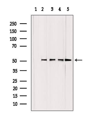 GCLC Antibody
