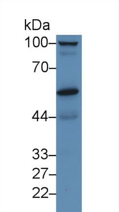 Polyclonal Rabbit anti-Human PRCP Antibody (APC, aa108-376, WB)