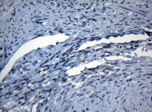 Monoclonal Mouse anti-Human AKT1 Antibody (clone OTI1D12, IHC, WB)