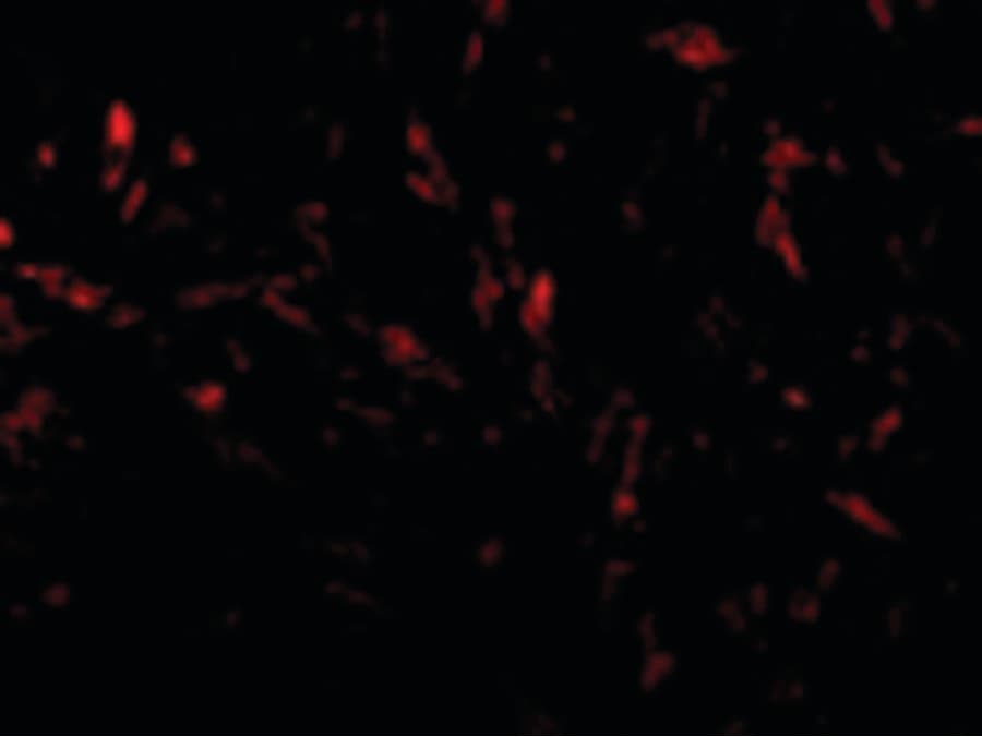 Polyclonal Rabbit anti-Human TTC5 Antibody (IHC, IF, WB)