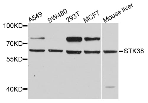STK38 Antibody