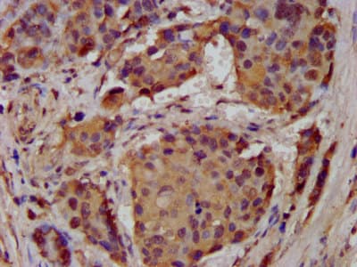Polyclonal Rabbit anti-Human ACCN1 / ASIC2 Antibody (IHC, IF)