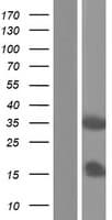 Human VAX1 Protein (Over-Expression Lysate Myc-DDK (Flag))
