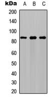 PFKM / PFK-1 Antibody (Internal)