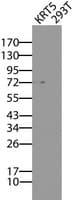 KRT5 / CK5 / Cytokeratin 5 Antibody (clone OTI1E6)