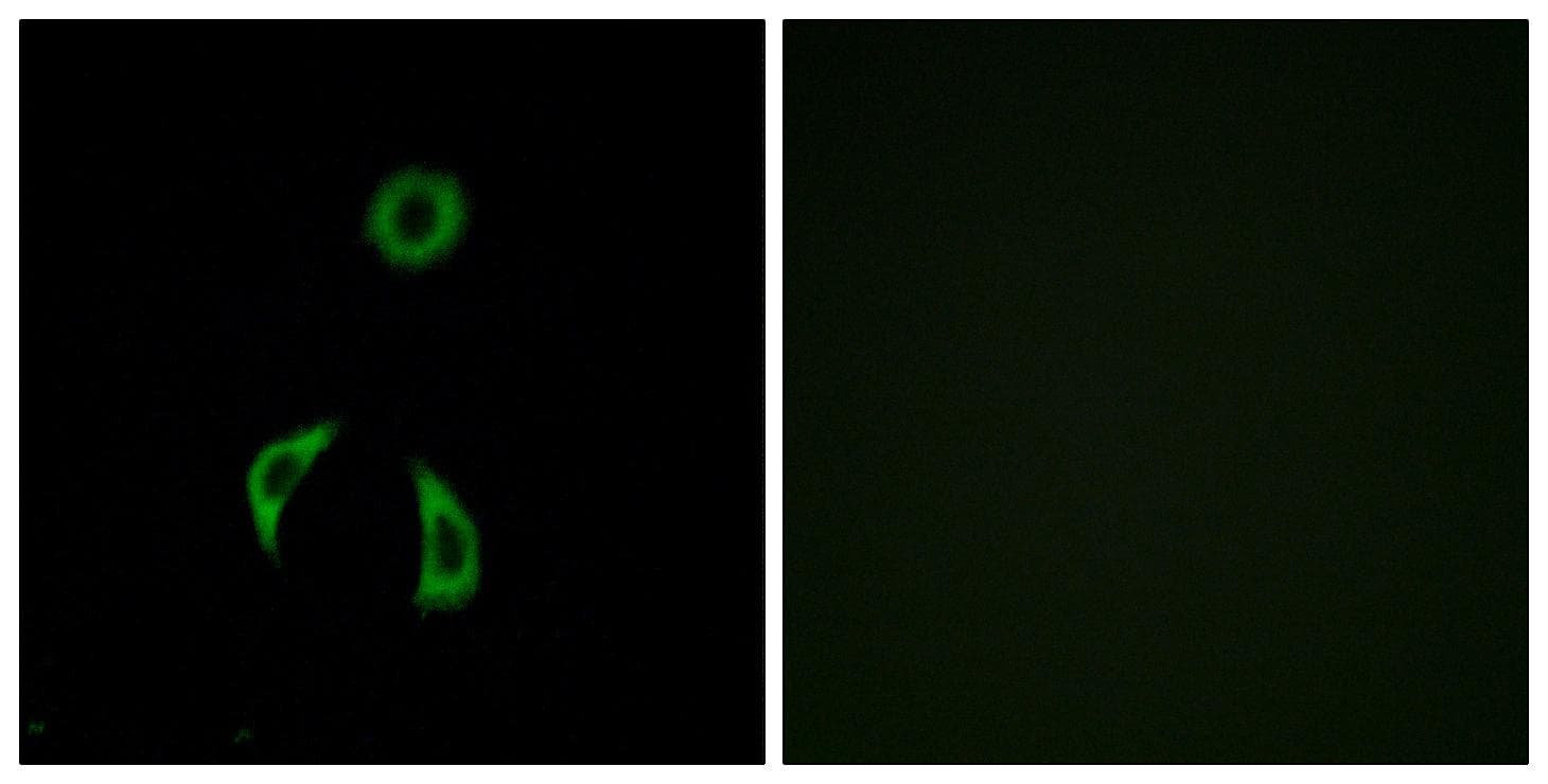 FZD3 / Frizzled 3 Antibody